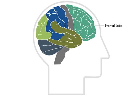 Frontal Lobes | Centre for Neuro Skills