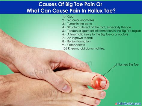 gout symptoms big toe