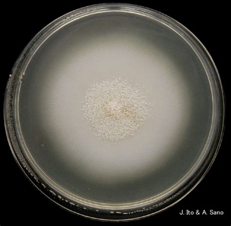 Blastomyces dermatitidis colony SDA