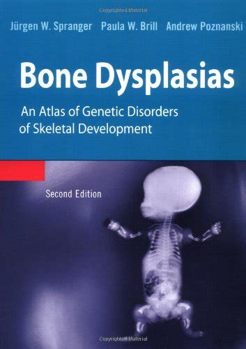 Bone Dysplasias: An Atlas of Genetic Disorders of Skeletal Development ...