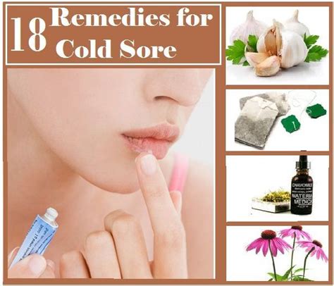 Home Remedies for Cold Sore | Cold home remedies, Cold sores remedies, Natural cold remedies