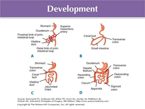 Meckel's diverticulum