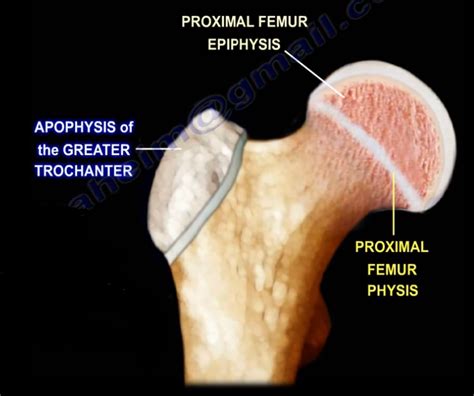 Growth Plates: Physis,Epiphysis, & Apophysis | by Nabil Ebraheim | Medium