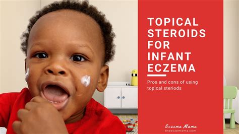 Topical Steroids for Infant Eczema: Pros and Cons - Eczema Mama