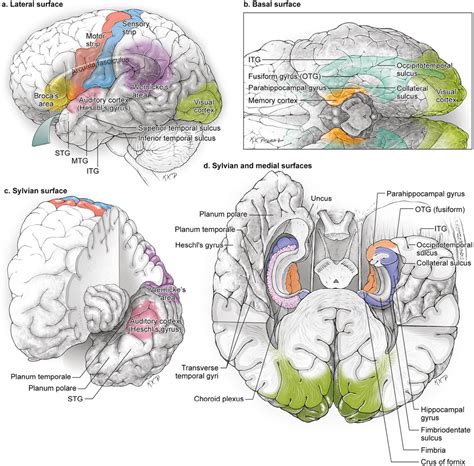 Temporal Arteriovenous Malformations | Neupsy Key