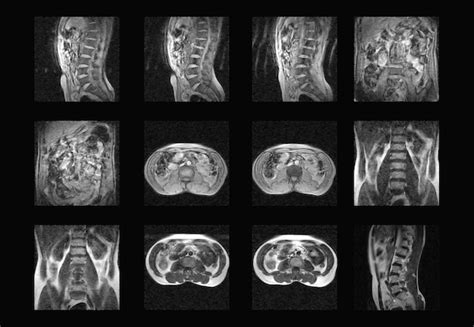 Premium Photo | Dorsal spine mri and ct scan professional xray images