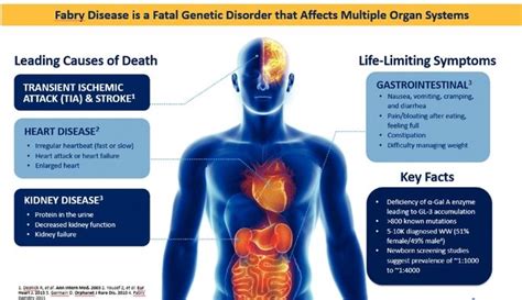 Fabry Disease Infographic #FabryDisease #Fabry_Disease #AndersonFabryDisease | Disease ...