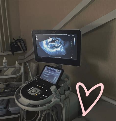 Ultrasound School, Baby Ultrasound, Ultrasound Pictures, Sonography Aesthetic, Sonography ...