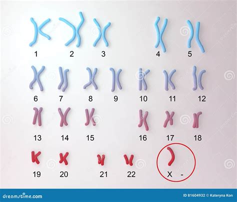 Turner S-syndrome Karyotype Stock Illustration - Illustration of structure, medical: 81604932