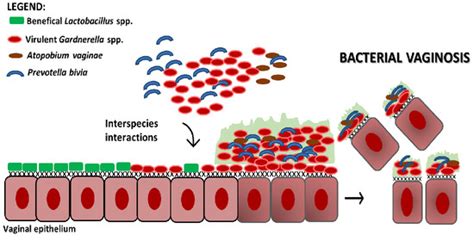 Pathogens | Free Full-Text | Atopobium vaginae and Prevotella bivia Are ...