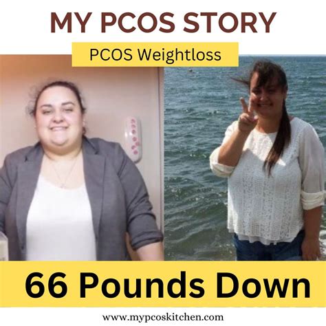 Metformin Pcos Weight Loss Before And After | Blog Dandk