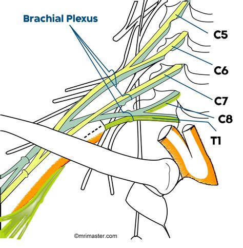 Brachial Plexus MRI Protocols, Planning And Indications, 53% OFF