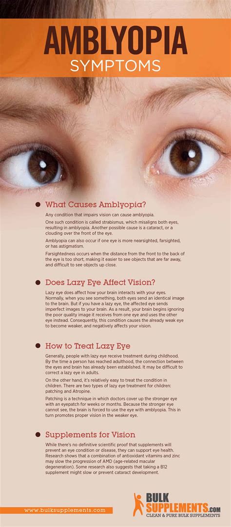 Tablo | Read 'Amblyopia (Lazy Eye) Symptoms, Diagnosis, and Treatment' by