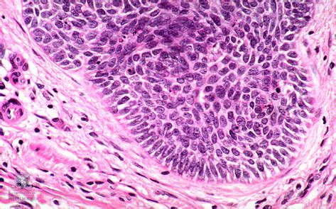 Skin Cells - Types of Cells in the Body