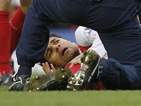 Eduardo Injury Bone