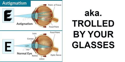 Jaanus' Optometrist: "Astigmatism Correction Is For Rare, Serious Cases ...