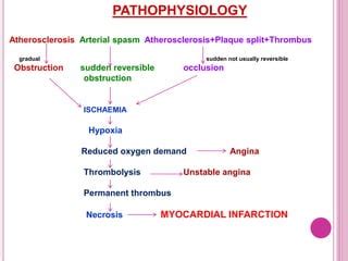 Myocardial infarction | PPT