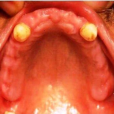 Intraoral preoperative view | Download Scientific Diagram