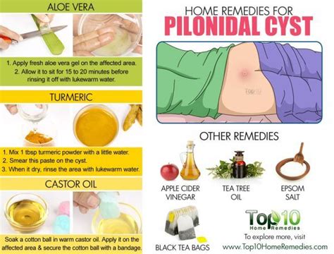 Home Remedies for Pilonidal Cysts (Large Pimple at Bottom of Tailbone ...