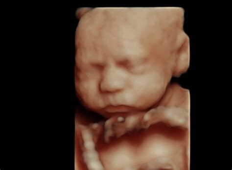 Eight Benefits of 4D Ultrasounds | Lollipop 4D Baby Scans