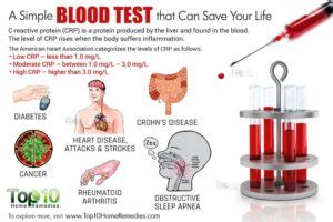 How High C-Reactive protein can risk your chance of Heart Disease! | Strive For Good Health