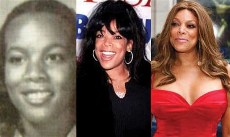 Wendy Williams Plastic Surgery Before and After Pictures 2018