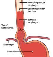 What are Gastroenterology Procedures | Oaklawn Hospital