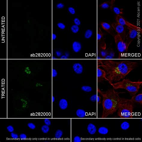 Recombinant Anti-IL-8 antibody [O-IL8-15] - Mouse IgG2a (ab282000) | Abcam