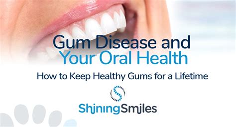 Gum Disease Prevention, Progression & Treatment Infographic – Shining Smiles Family Dentistry