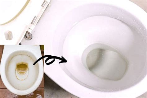 How to Clean a Very Stained Toilet Bowl