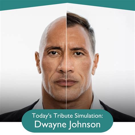 Explore our Dwayne Johnson Hair Transplant Simulation!