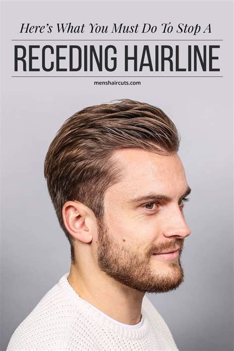 Here’s What You Must Do To Stop A Receding Hairline ★ Long Hair ...