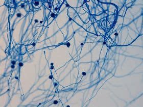 Fun With Microbiology (What's Buggin' You?): Aspergillus flavus ...