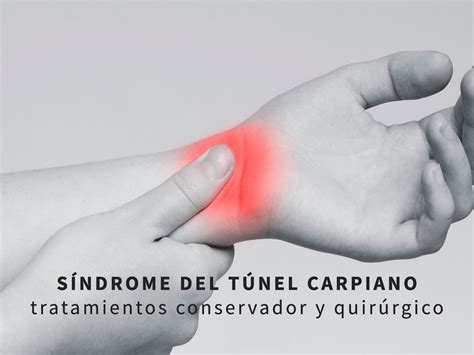 tratamiento-del-sindrome-del-tunel-carpiano-F | ICONICA Servicios Médicos