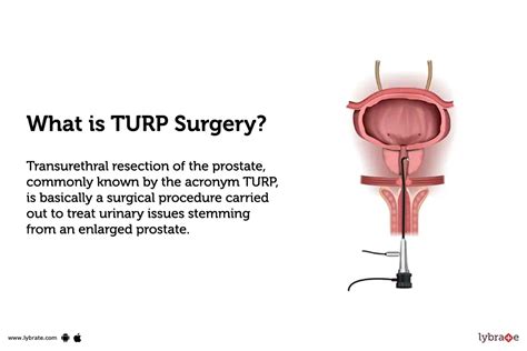 Transurethral Resection Of The Prostate (TURP): Purpose, Procedure, Benefits and Side Effects