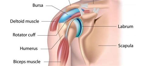 Bursectomy, bursectomy procedure, bursectomy complications & recovery