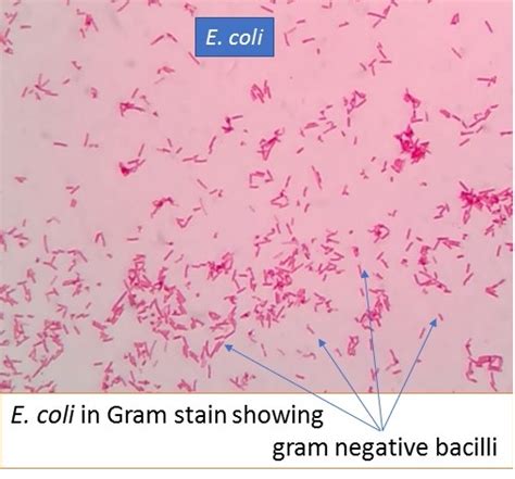 E. coli in gram stain: Introduction, Pathogenic strains and lab diagnosis