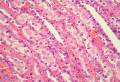 Hydropic degeneration of the epithelium of the straight tubules... | Download Scientific Diagram