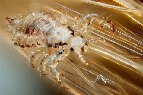 Can Head Lice Live On Pillows And Sheets? - Smart Sleeping Tips