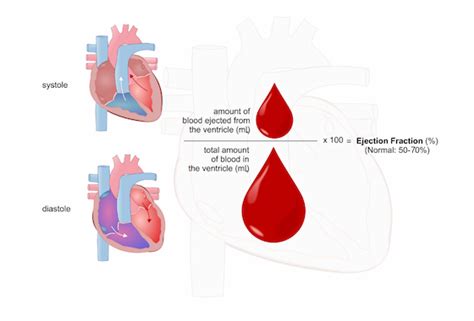 How to Calculate Left Ventricular Ejection Fraction | NursingCenter