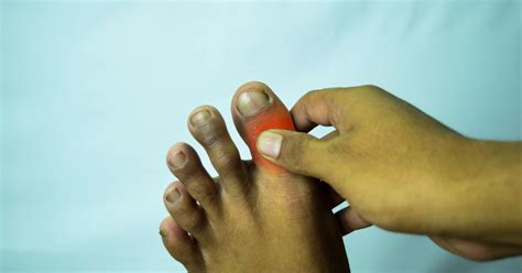 7 Common Causes of Big Toe Pain