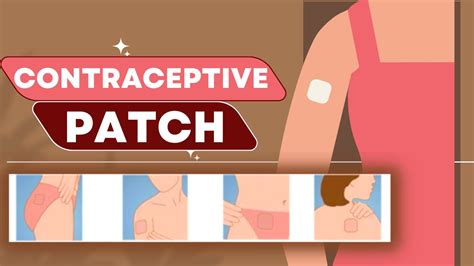 Contraceptive Patch How It Works