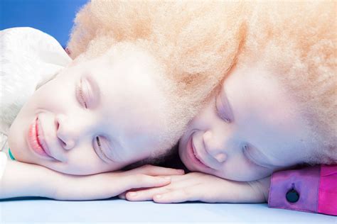 Albino Twins From Brazil Are Challenging The Fashion Industry With ...