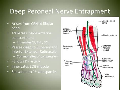 Deep Peroneal Nerve Palsy