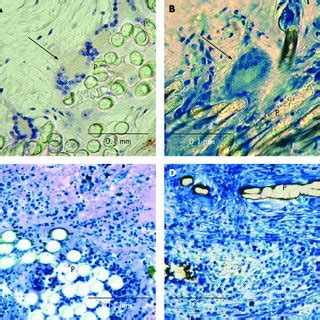 Inflammatory reactions. Histological images of inflammatory reactions... | Download Scientific ...