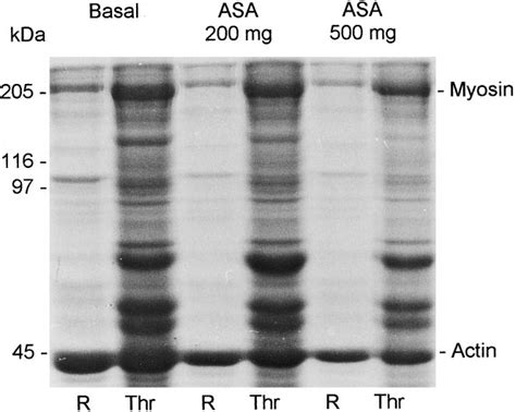 Coomassie blue-stained gel containing platelet | Download Scientific Diagram