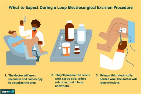 The Facts About Pregnancy After a LEEP Procedure