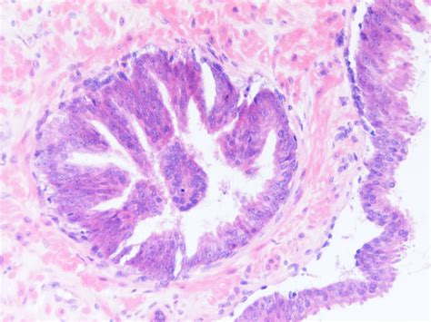 sektor Teplo věřit pin histology Diktatura Lízat hlavní země