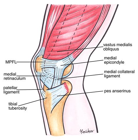 MR Imaging of Patellar Instability: Injury Patterns and Assessment of Risk Factors | RadioGraphics