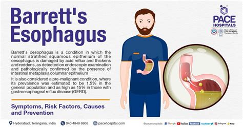 Barrett's esophagus – Symptoms, Causes, Types and Complications